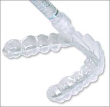 Toronto Teeth Whitening Mold Trays