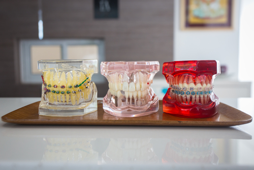 North York Dentist M3H 5Y4